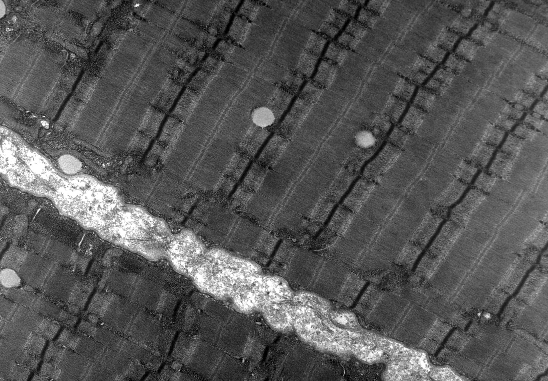 Human skeletal muscle, electron micrograph: myofibrils and sarcomere bands