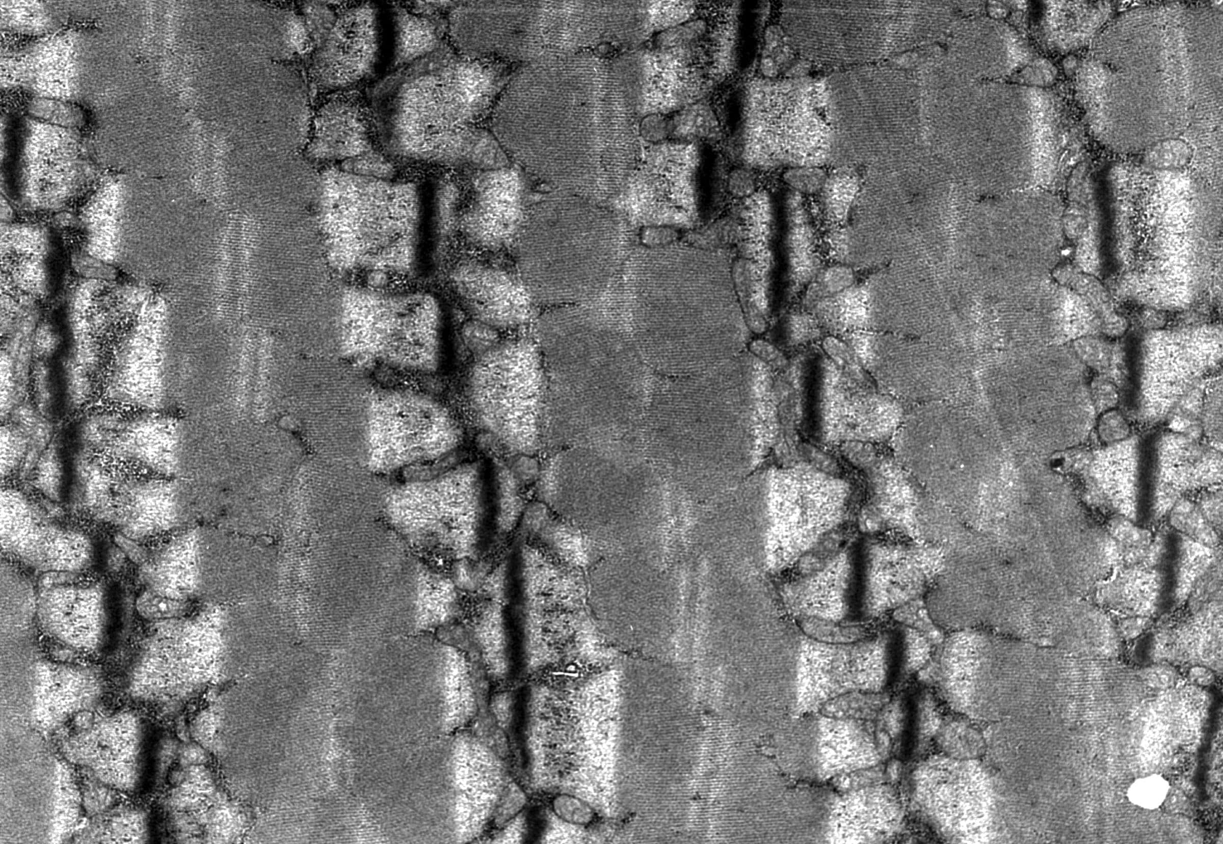 Human skeletal muscle, electron micrograph: paired mitochondria sit beside each Z-line